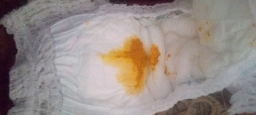 ปกติไหมค้ะ