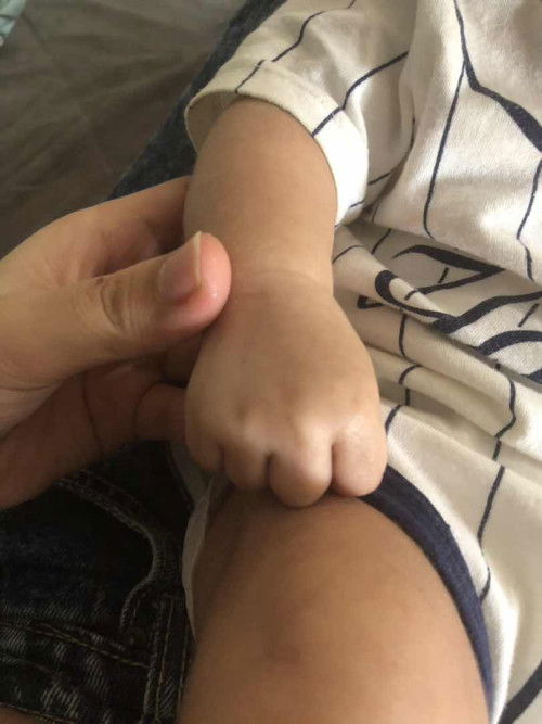 ชอบกำมือกำหมัด