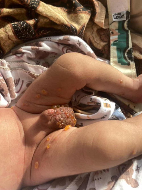 Gimna sembuhnya tolong bantu jawab?