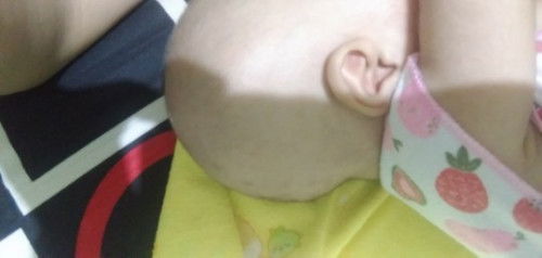 Bentuk kepala bayi usia 1bln 27hari