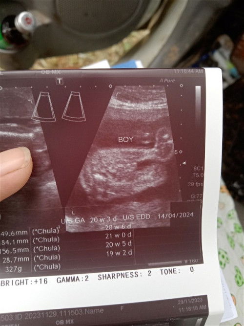 มีใครดูออกไหมคะว่าน้องเป็นผช.