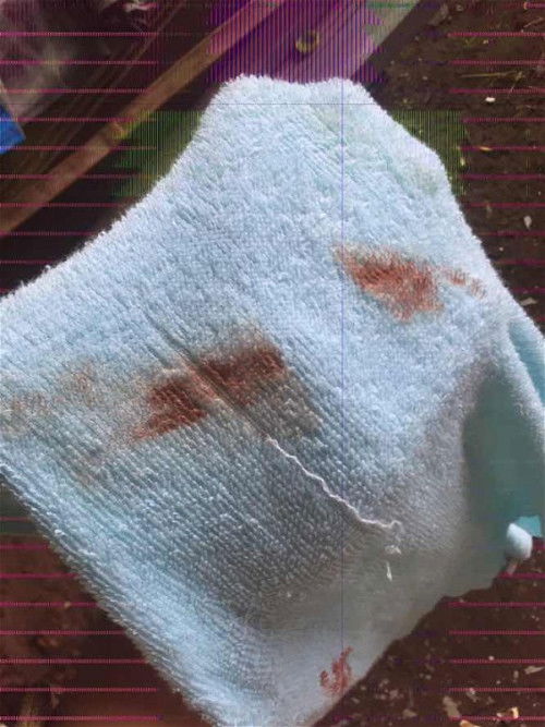 ควรทำอย่างไรดีคะ