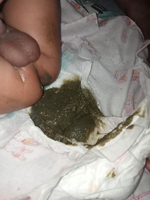 กินนมหมีสูตร1แบบนี้ถ่ายสีปกติมั้ยคะ