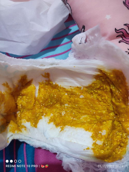 Tekstur feses bayi 3 bulan kuning dan cair