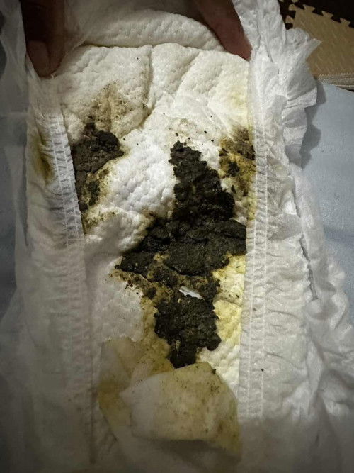 Baby stool after eating banana