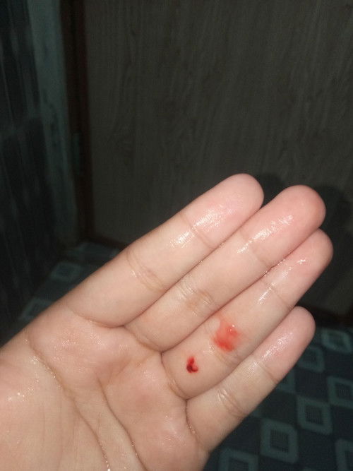 Tiap pipi beberapa x keluar flek