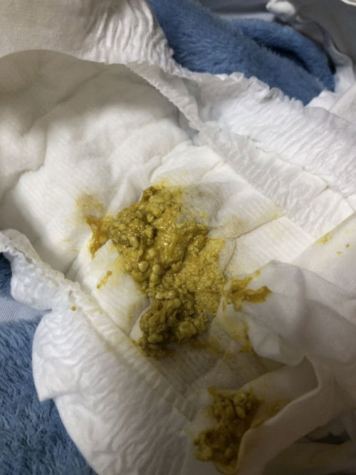 Hỏi về tình trạng phân