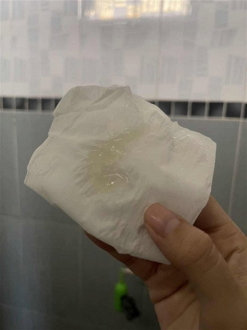 เหมือนเป็นใส่ๆเหมือนน้ำมูก แบบนี้ ปกติมั้ยคะ