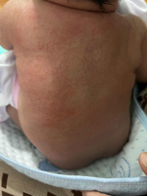 Bé e đk hơn 1 tháng tuổi