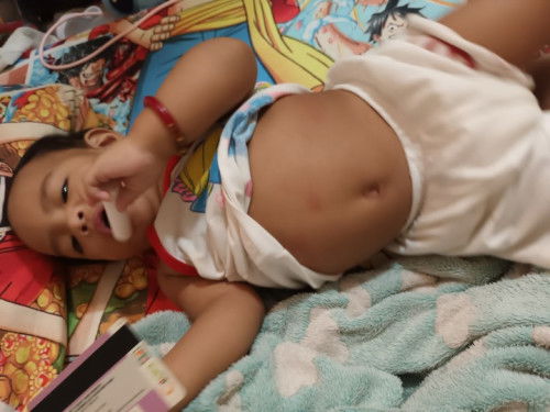 Normal po ba malaki ang tiyan ng baby 1 yr old po siya pero malambot naman po ung tummy