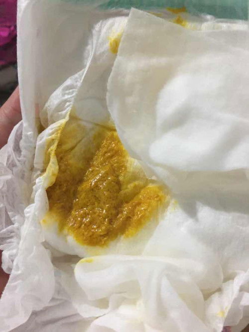 อึปกติมั๊ยคะแบบนี้