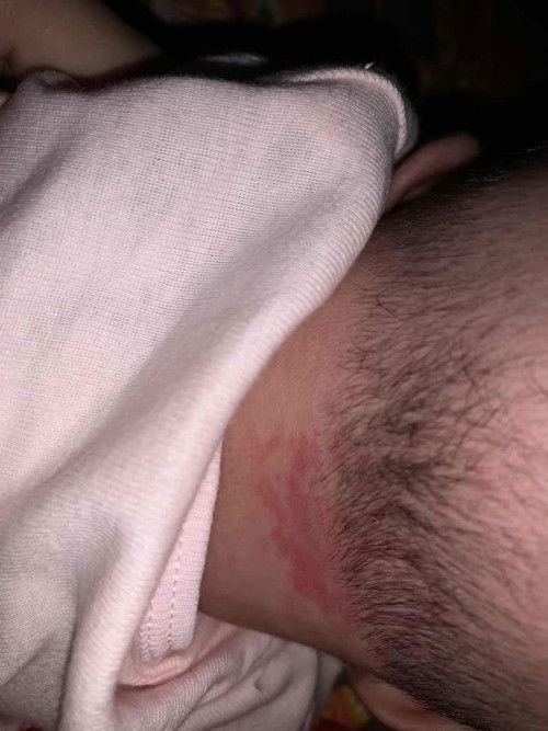 Belakang kepala baby