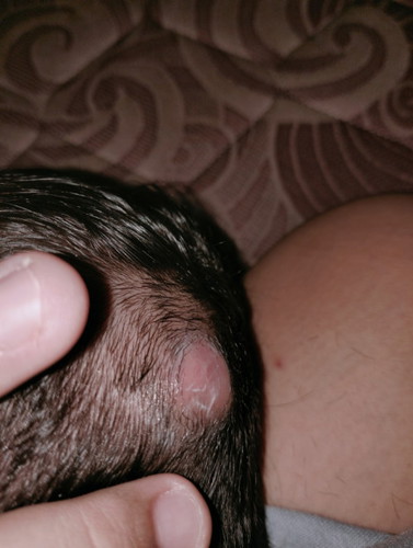 Benjolan belakang kepala bayi umur 3 minggu mohon solusi dan penanganan nya