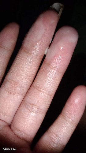 Bun saya hamil 36 week keluar cairan Ini terus kira kira ini ketuban rembes apa cairan vagina