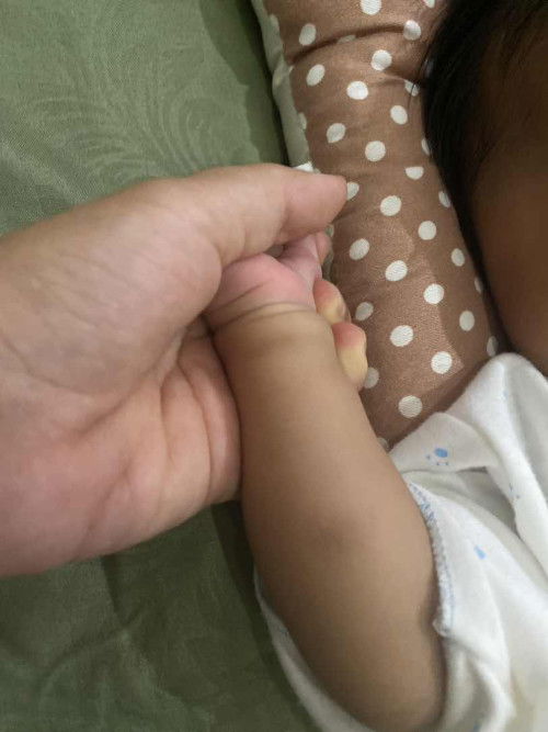 Bekas gigitan nyamuk