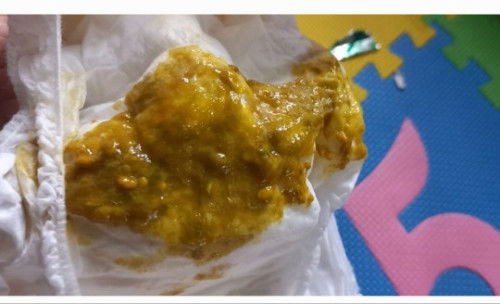 Bab anak setelah minum sufor