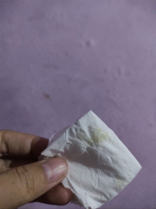 maaf jorok! usia kehamilan 37 minggu