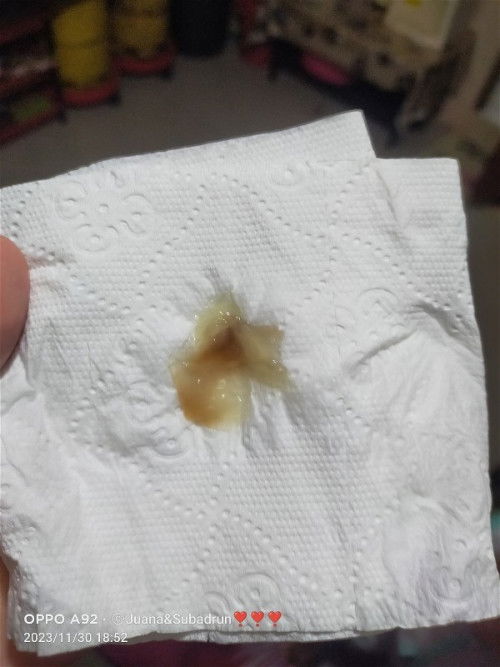 Assalamualaikum ibu²..brpa hari ni keluar tanda mucus plug..smlm lendir+darah..