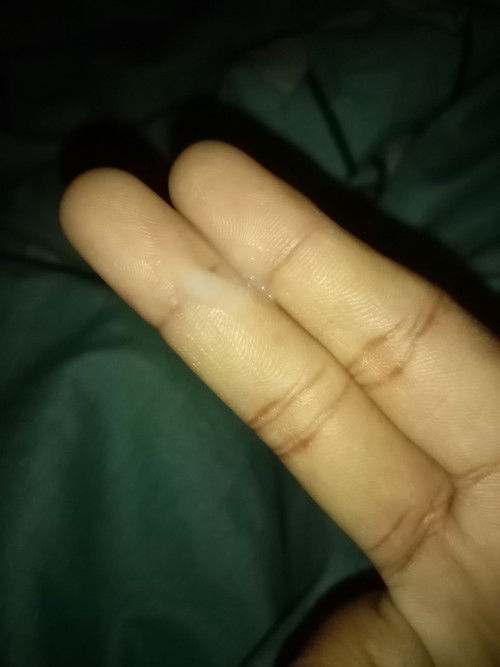 Assalamualaikum sye nk tanye nie air putih ke tanda lain