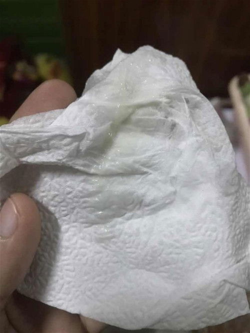 ขอถาแม่ๆค่ะ แบบนี้ตกขาวหรือมูกคะ