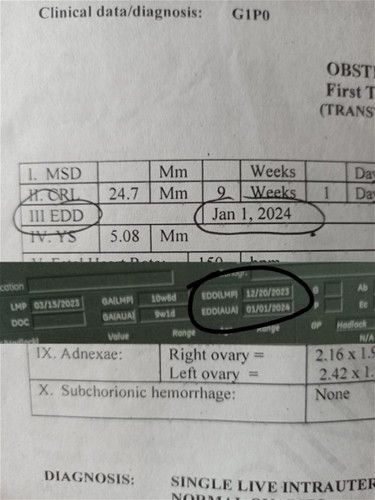 LMP o AUA anu dapat sundin, TVS result