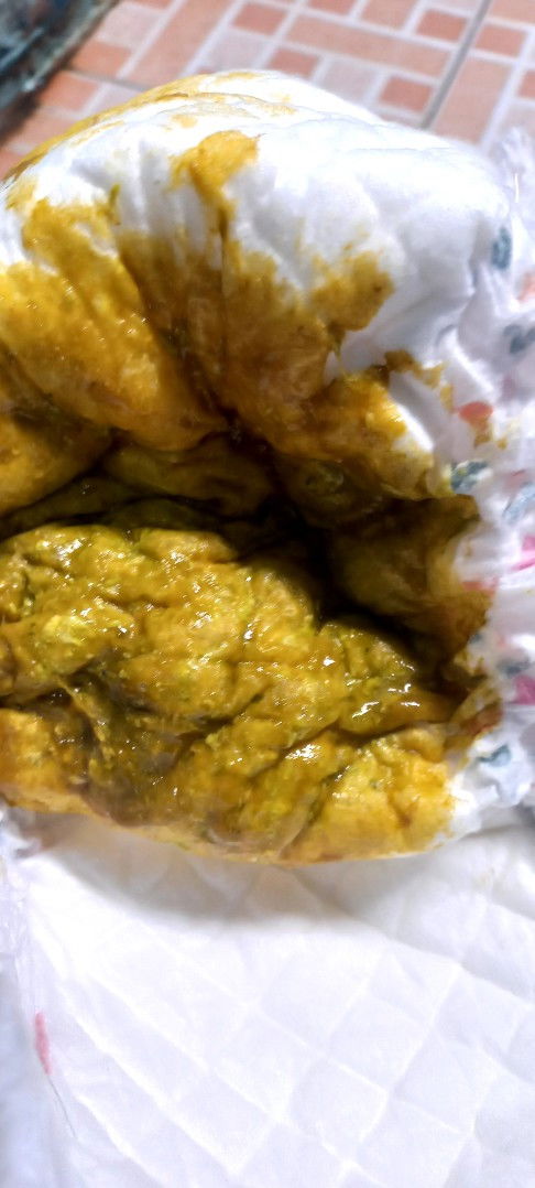 Tanda diare apa bukan yah bun?