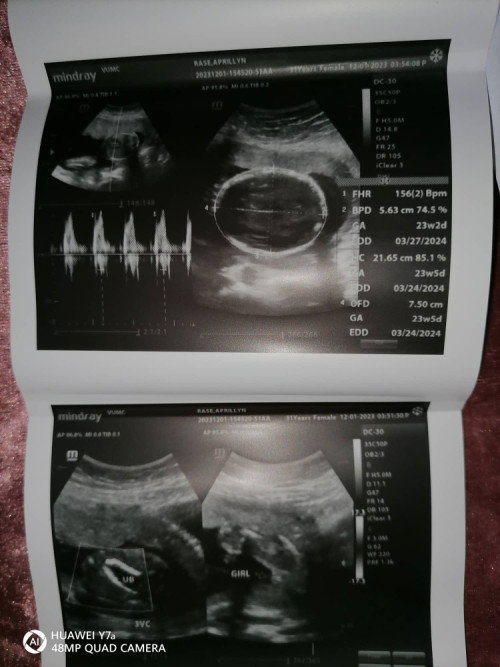 Hello po ask ko lang sure po ba na baby girl na po 😊☺️😅