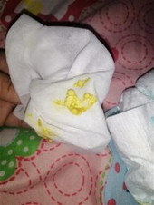 Kulay ng poop ng newborn baby