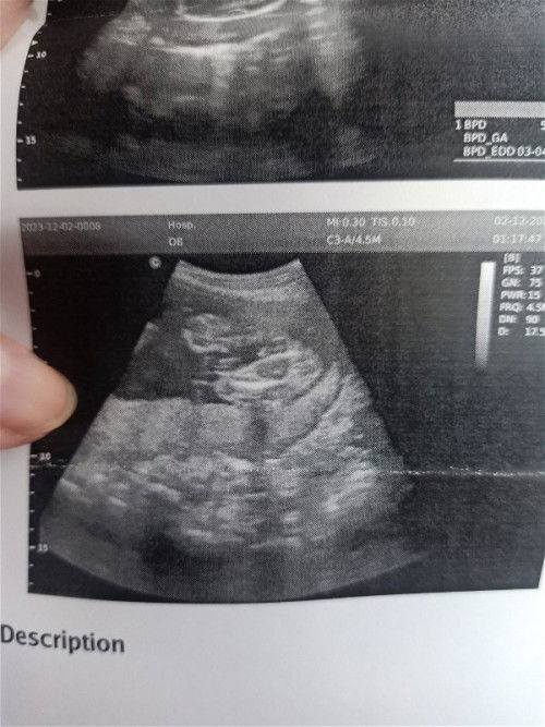 อยากถามแม่ที่มีประสบการณ์เดือนพฤศจิกายนหมอบอกว่าได้ลูกสาวชัวร์วันนี้ไปหาหมอหมอสาวบอกว่าได้ลูกชาย