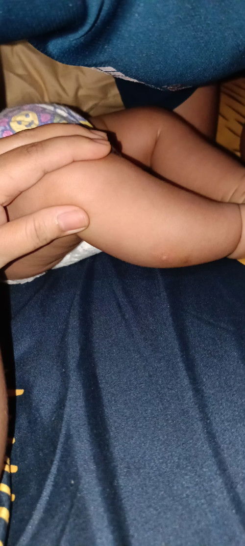 bun anaknya ada gak yg kulitnya kaya gini