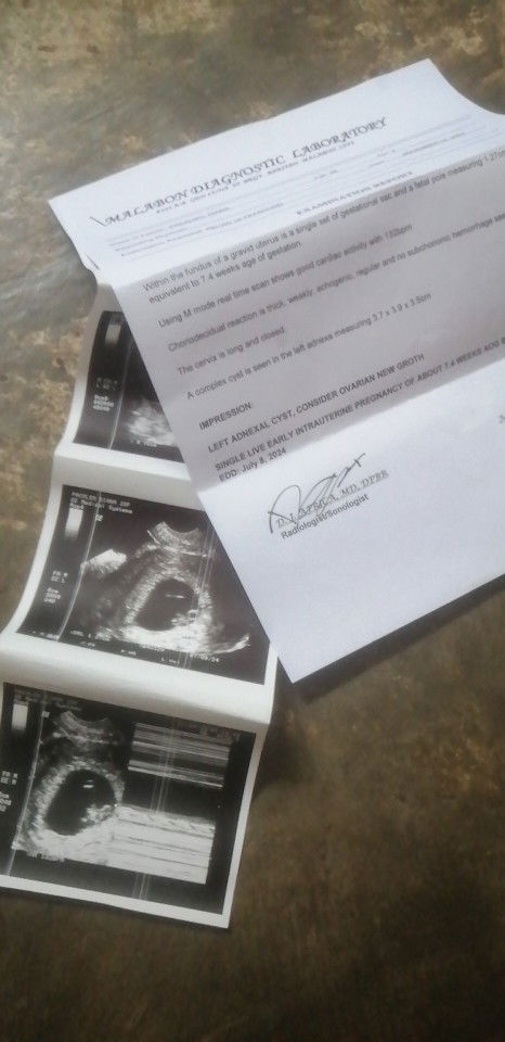 Just want to know kung kelan kaya ako nag fertille kelan ako banda nadale at na preggy ako now ??