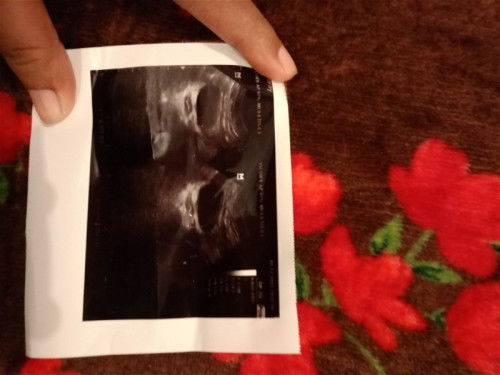 Berbagi cerita dan minta tanggapan