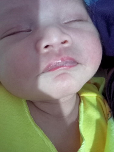 Maaf Bun ada gak bayi baru 8 hari tapi mulut bagian dalam berwarna putih2 Kya di foto,,new mom