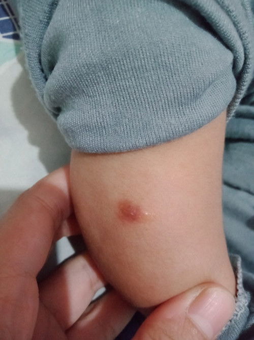 Hallo mom ada yang tau ini apa bintik? Letaknya ada di kaki.