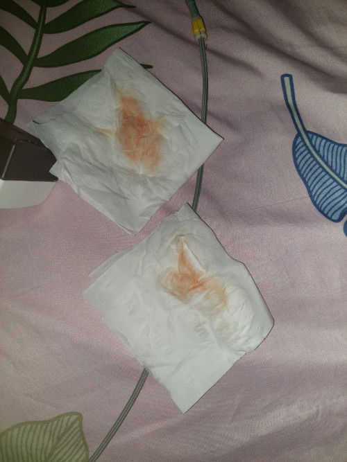 Di cek pembukaan belum ada, 
Setelah di cek pembukaan keluar darah segar