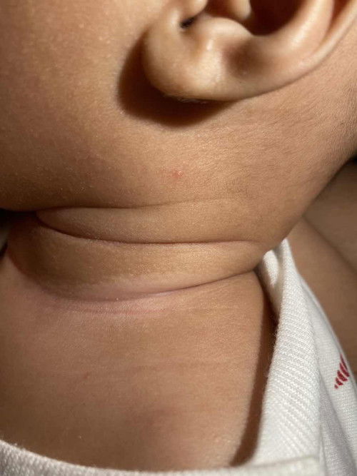 Ini dileher bayi apa yaa?