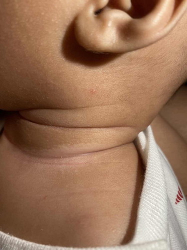 Ini dileher bayi apa yaa?