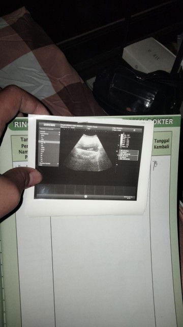 Hasil USG 5 Minggu 2 Hari