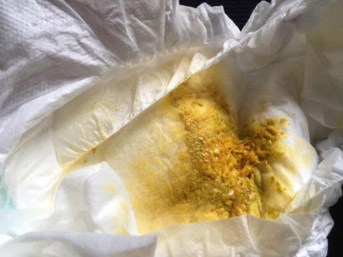 สีอึแบบนี้ผิดปกติมั๊ยคะ ลูกคนแรกกังวลไปหมดค่ะ😮‍💨