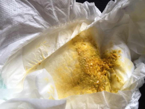 สีอึแบบนี้ผิดปกติมั๊ยคะ ลูกคนแรกกังวลไปหมดค่ะ😮💨