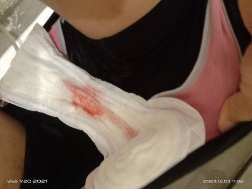 Bleeding di usia 10w pregnancy
