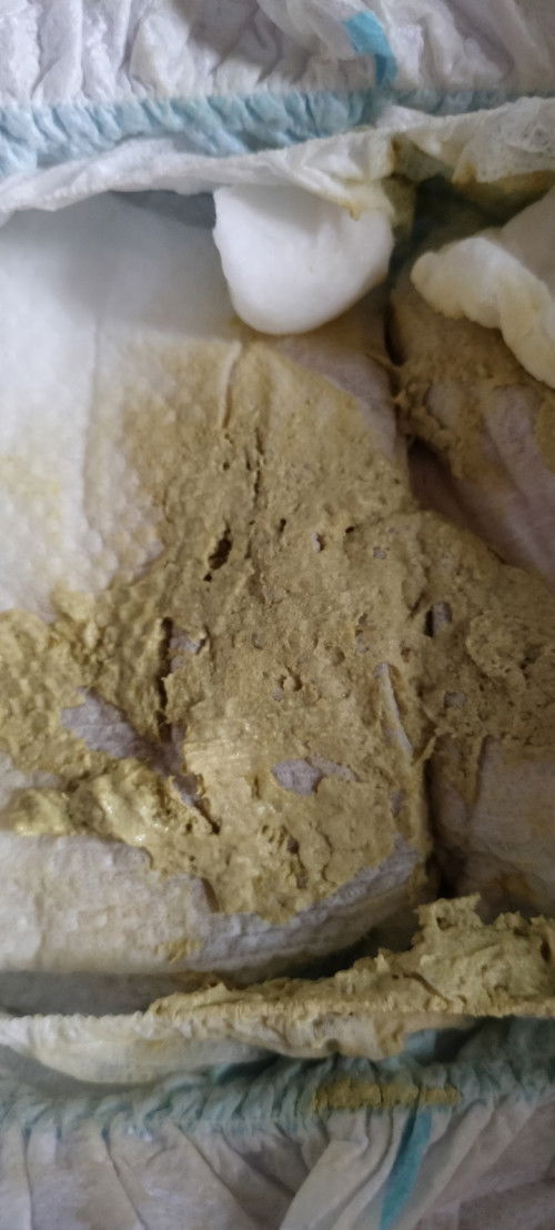 Baby 6months old stool