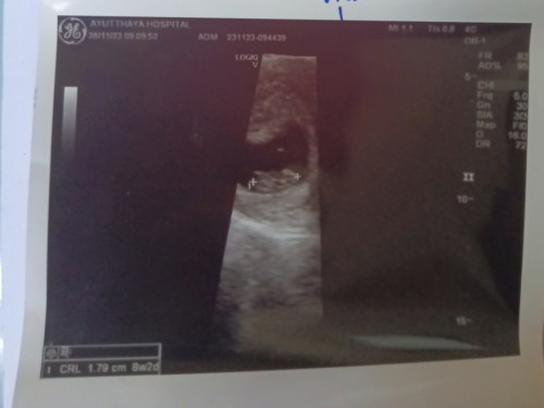 เจอน้องแล้ว