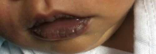 Black / Chapped Lips newborn