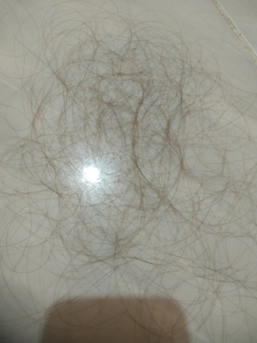 Rambut rontok