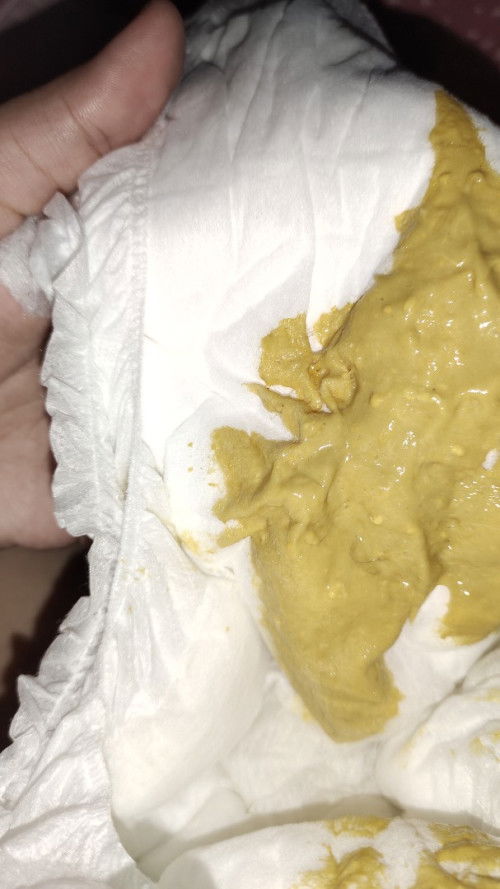 Pup bayi kuning pucat