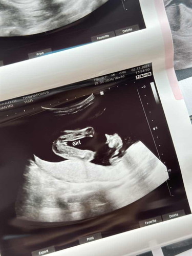 ตั้งครรภ์ 18w6d