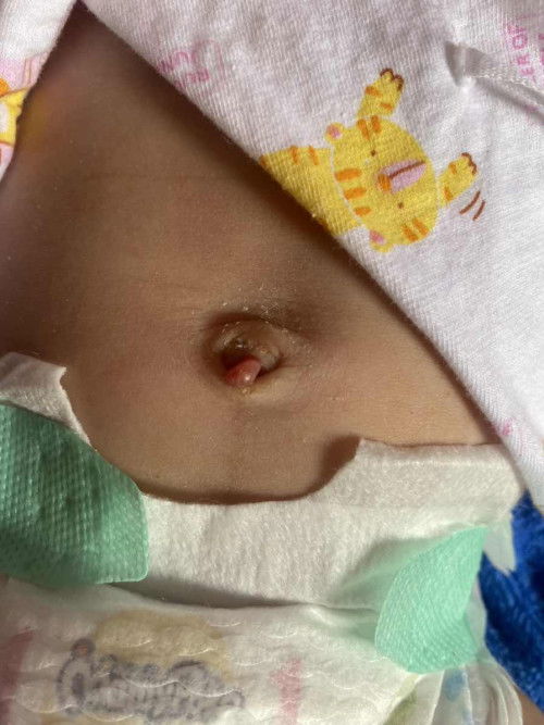 เเบบนี้น้องเป้นอะไรคะ