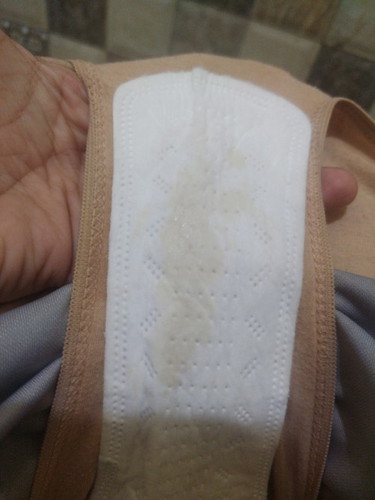 8 weeks Preggy, may discharge