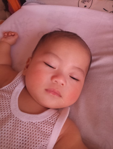 Ano po kaya pwede maging dahilan ng pamumula ng pisngi ni baby